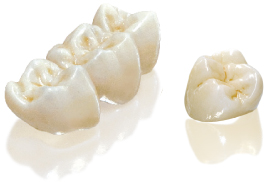 What You Need to Know About Dental Crowns